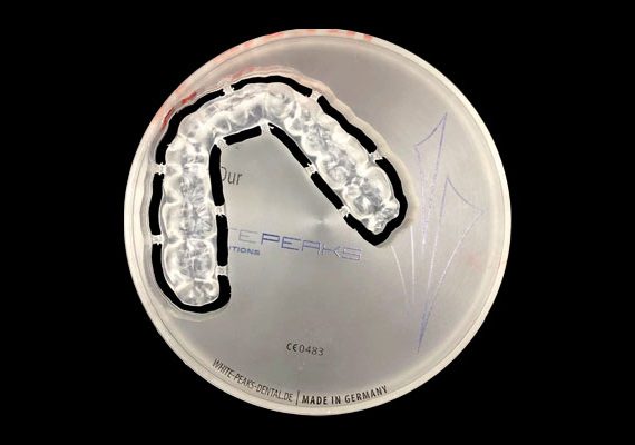 LOG-laboratorio-odontotecnico-torino-protesi-23