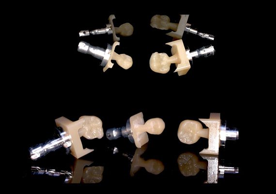 laboratorio-odontotecnico-digitale-gusetti-torino-1